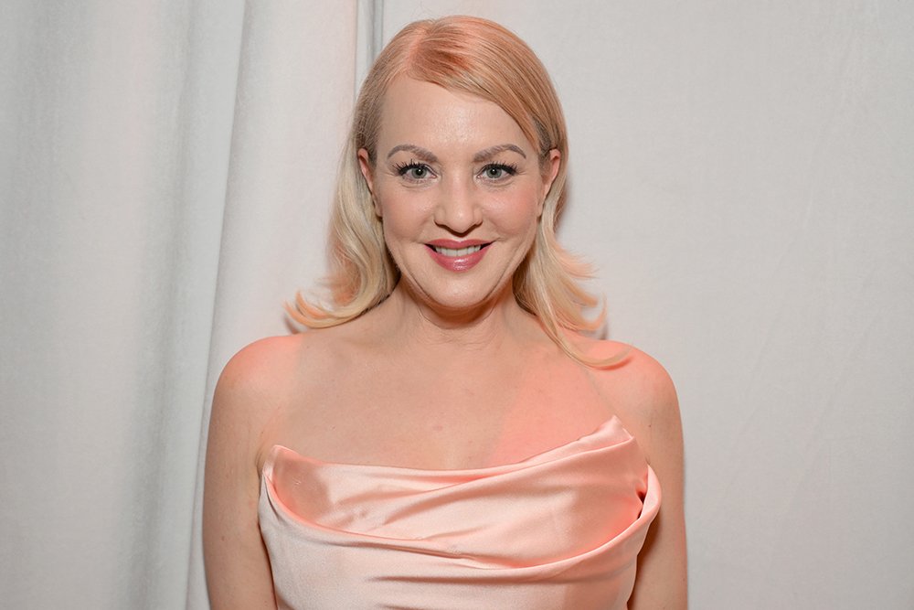 Wendi McLendon-Covey Reveals the Cosmetic Procedure That Kept Her From the ‘Bridesmaids’ Oscars Reunion